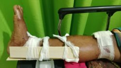 Pemuda Sirapit Dihadang dan Disiksa Gerombolan Preman, Urat Kaki Putus Dipotong