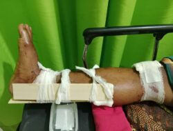 Pemuda Sirapit Dihadang dan Disiksa Gerombolan Preman, Urat Kaki Putus Dipotong